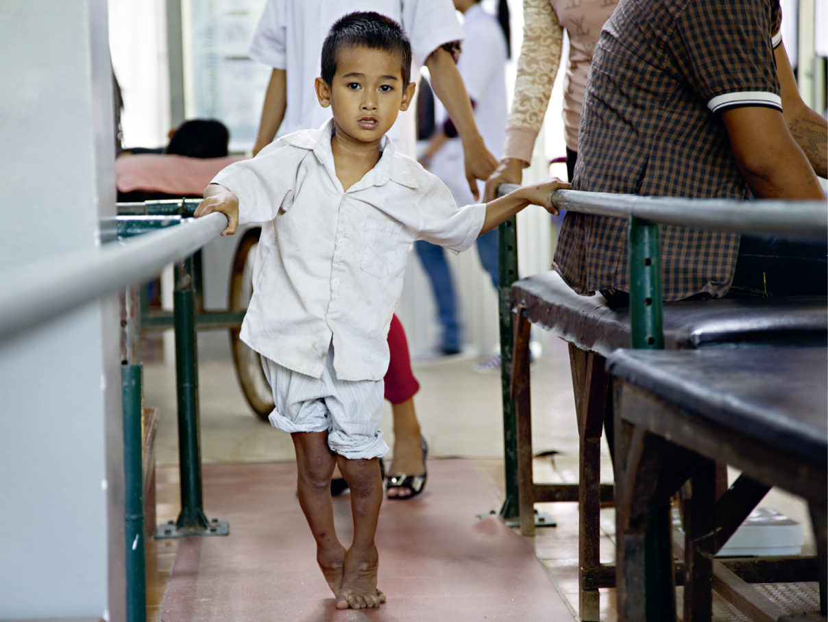 Battambang, centre r gional de r adaptation physique soutenu par le CICR  Une jeune patient handicap  des suites d'une polio s'entra ne   la marche  Battambang, Regional Physical Rehabilitation Centre supported by the ICRC  A young patient disabled because of the polio practises walking 